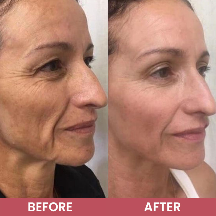 LIMETOW® Compact Anti-Wrinkle Bar