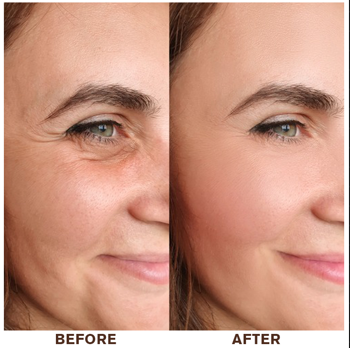 LIMETOW® Instant Eye Cream Tightener✨