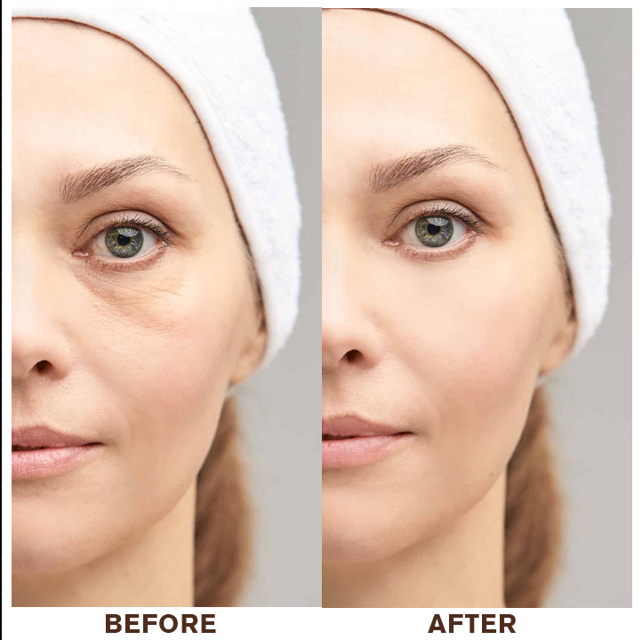 LIMETOW® Instant Eye Cream Tightener✨