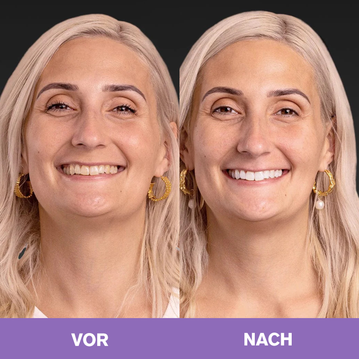 LIMETOW ® lächeln.