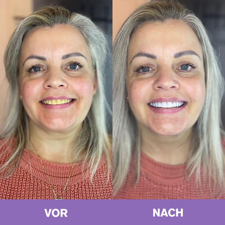 LIMETOW ® lächeln.