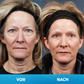 LIMETOW® Unsichtbares Facelift-Tape