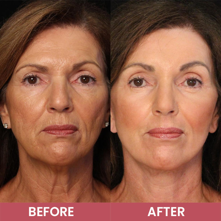 LIMETOW® Compact Anti-Wrinkle Bar